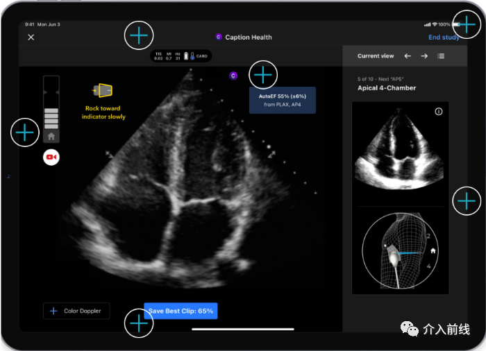 AI Ultrasound from Caption Health